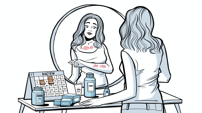 Život s chronickou kopřivkou